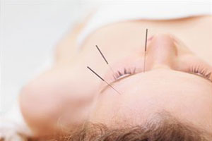 Преимущества акупунктуры